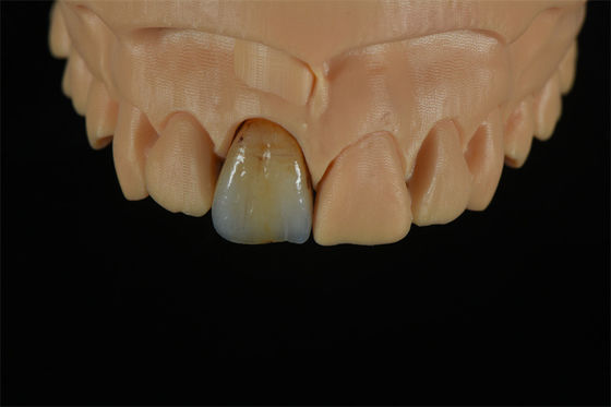 качество  Affordable Zirconia Crowns with Custom Color Staining - China Dental Lab завод